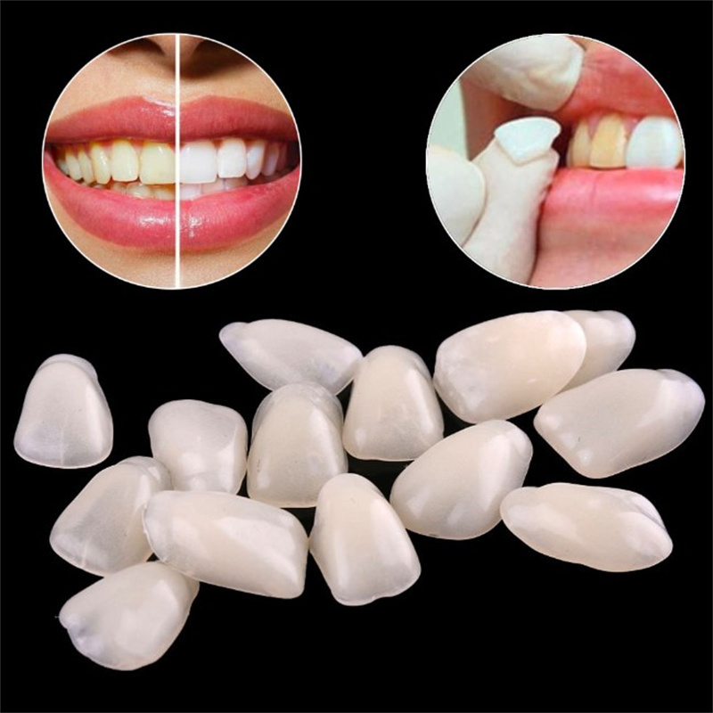 Teeth Whitening Mask - Geçici Diş Kaplamaları - Diş Beyazlatma