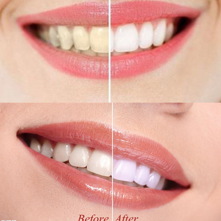 Bambu kömür diş diş diş hekimi - Teeth Whitening Charcoal incelemesi ve fiyatı