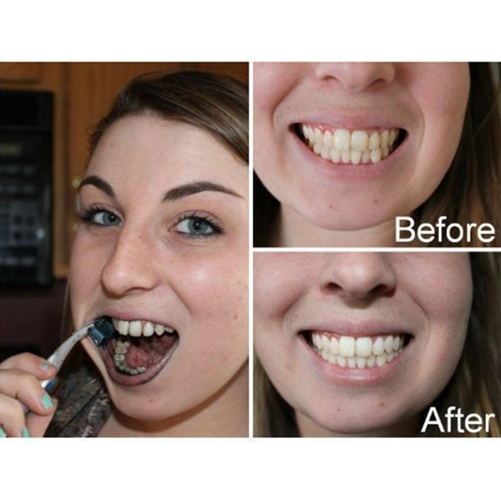 Bambu kömür diş diş diş hekimi - Teeth Whitening Charcoal incelemesi ve fiyatı