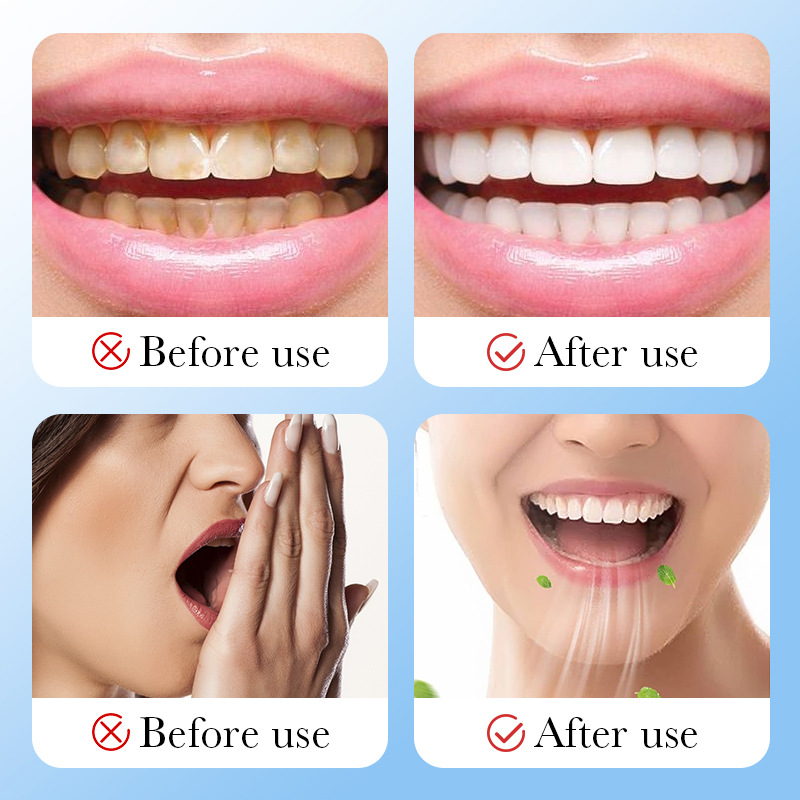 Bambu Kömürü Aktif Kömür Beyaz - Teeth Whitening Charcoal incelemesi ve fiyatı