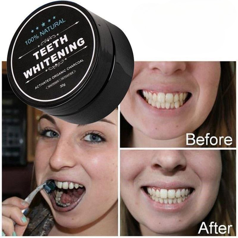 1 Kutu Aktif Kömür Diş Beyazla - Teeth Whitening Charcoal incelemesi ve fiyatı