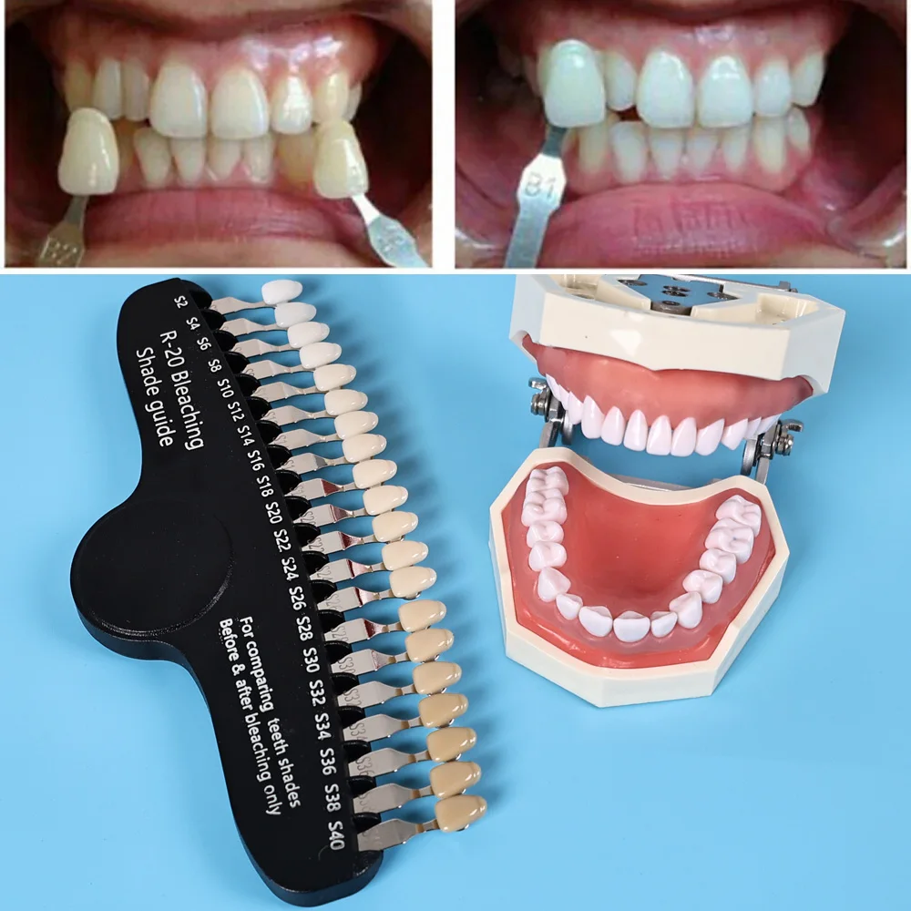 ELIJAH R-20 Ağartma Gölge Kıla - Teeth Whitening Shade Guide incelemesi ve fiyatı