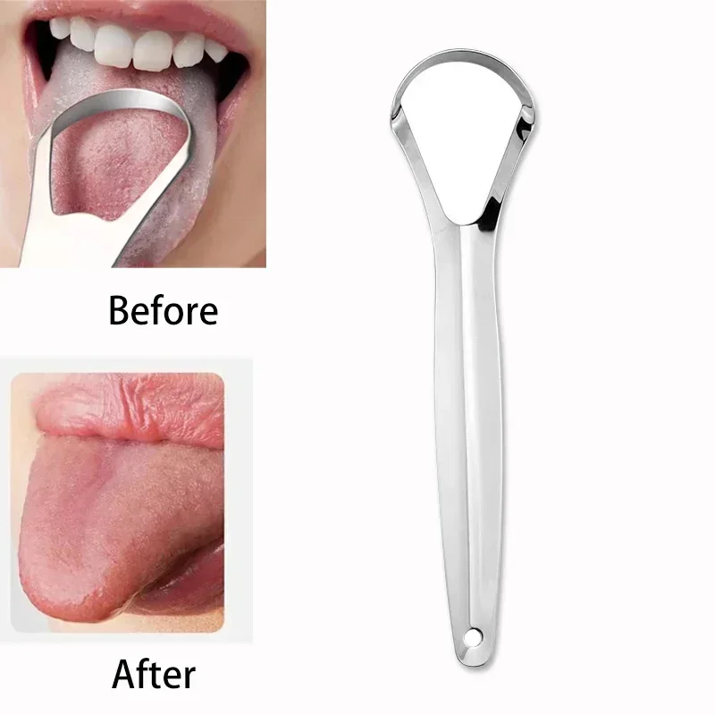 Halitosis Dil Kaplaması Dil Ka - Tongue Scraper Metal incelemesi ve fiyatı