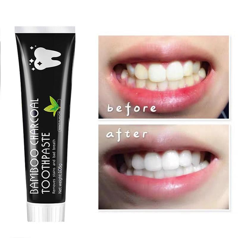 Diğer Diğer Diş Beyazlatıcı Ak - Teeth Whitening Charcoal incelemesi ve fiyatı